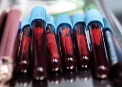 آیا بیوپسی مایع می تواند مقدار پاسخ سرطان پستان به درمان را زودتر پیش بینی کند؟