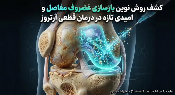 کشف روش نوین بازسازی غضروف مفاصل و امیدی تازه در درمان قطعی آرتروز