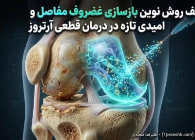 کشف روش نوین بازسازی غضروف مفاصل و امیدی تازه در درمان قطعی آرتروز
